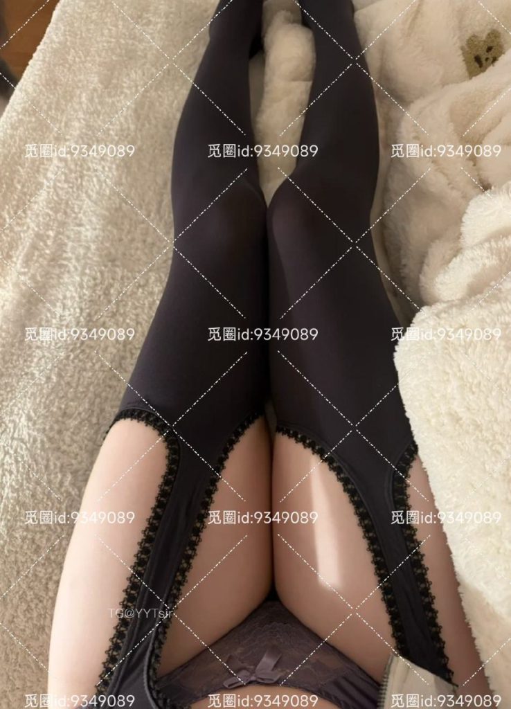 图片[2]-香香腿毛